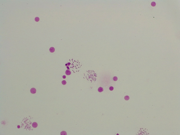 Female Chromosomes Slides - Female Chromosomes 05 200X